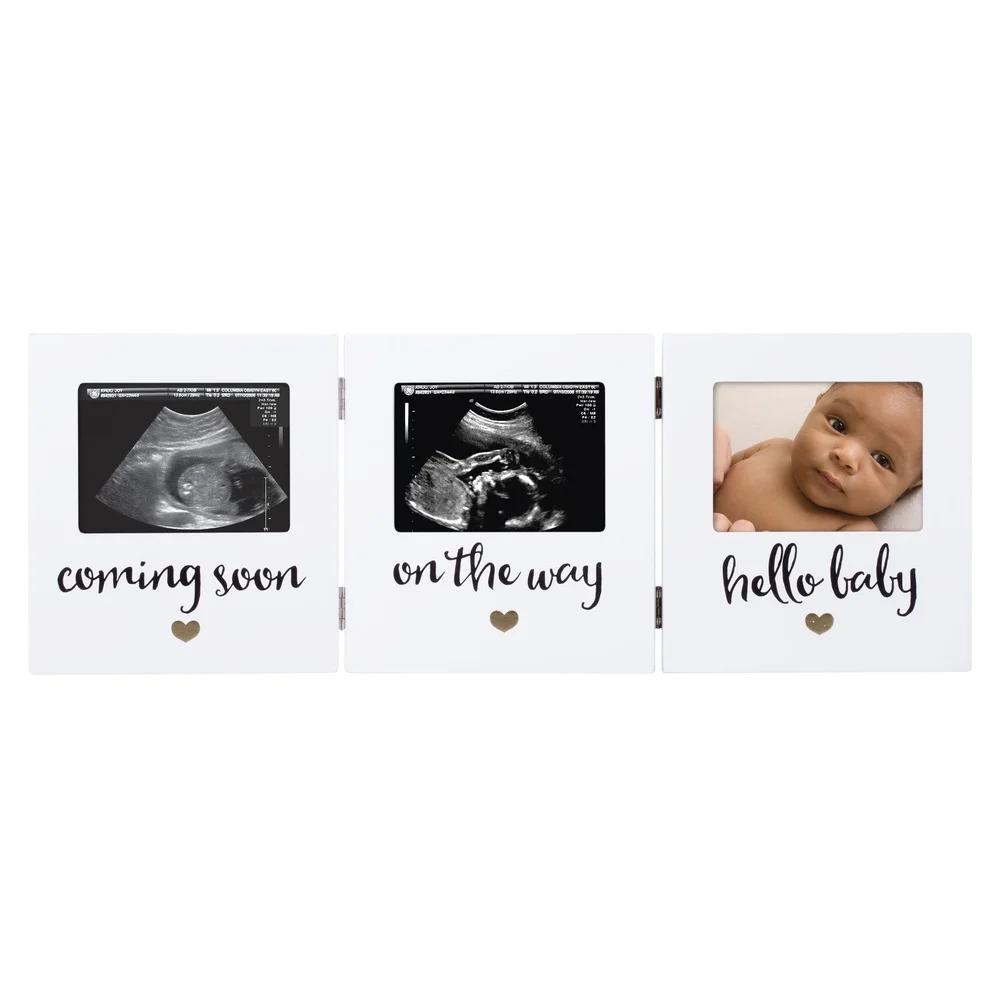 Triple Sonogram Keepsake Baby Picture Frame White Hinged Display Ultrasound Pregnancy Journey Ideal Gift Expecting Parents 3