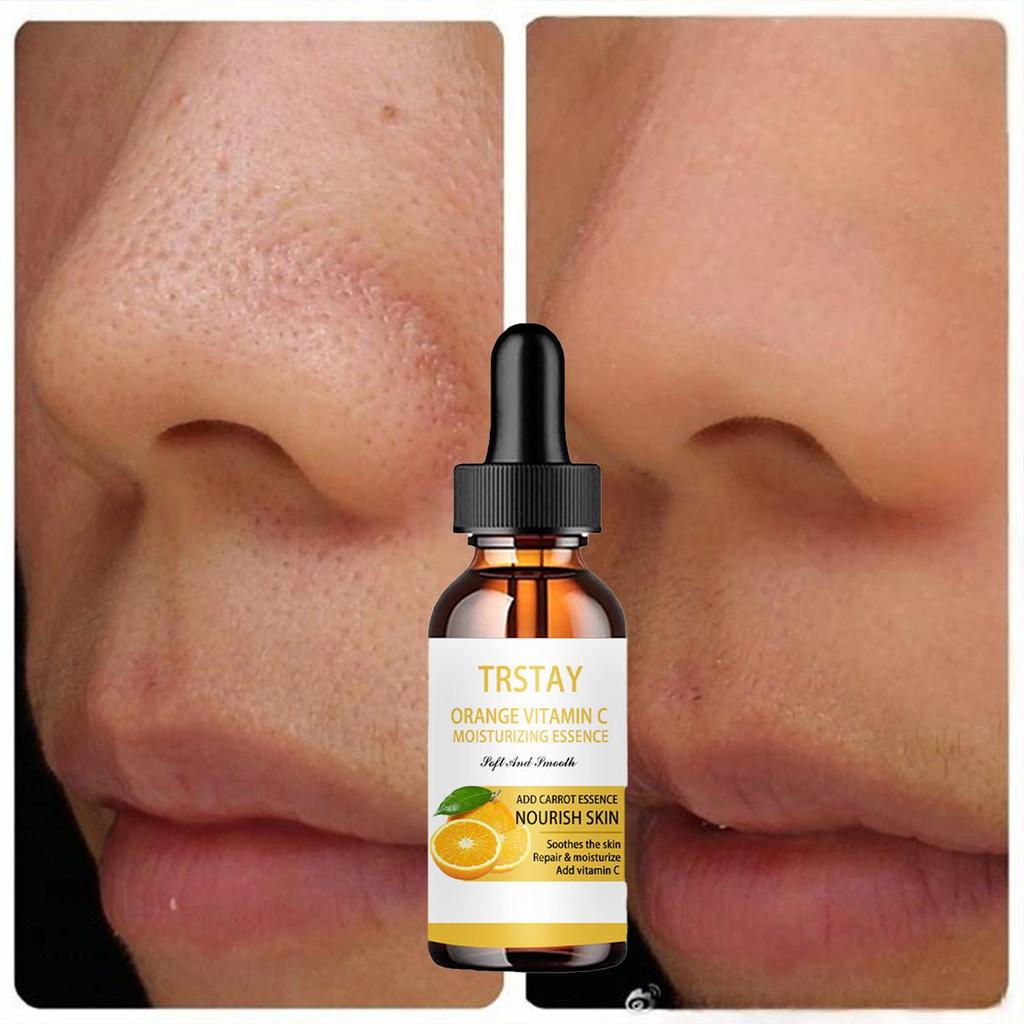 Orange Vitamin C Vitalizing Essence Soft, Smooth and Moisturizing Essence Water Skin Soothing, Repairing and Supplementing Vitamin Whitening Lotion