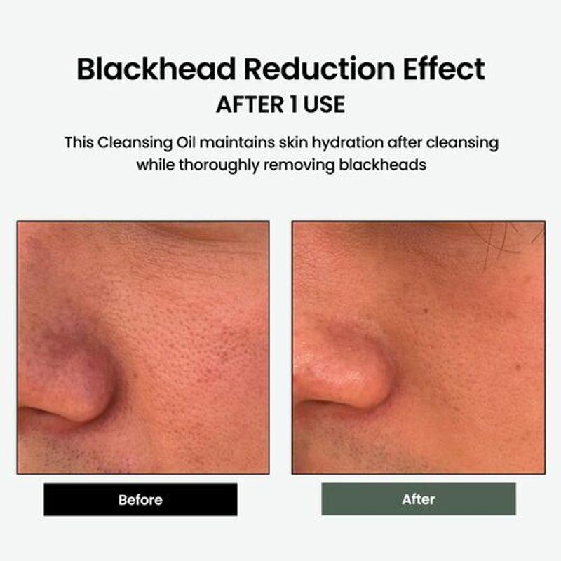 [delphyr] Liposome Daily Cleansing Oil 200ml