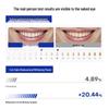 VEBANLER Fruit Acid Whitening & Stain Removal Toothpaste