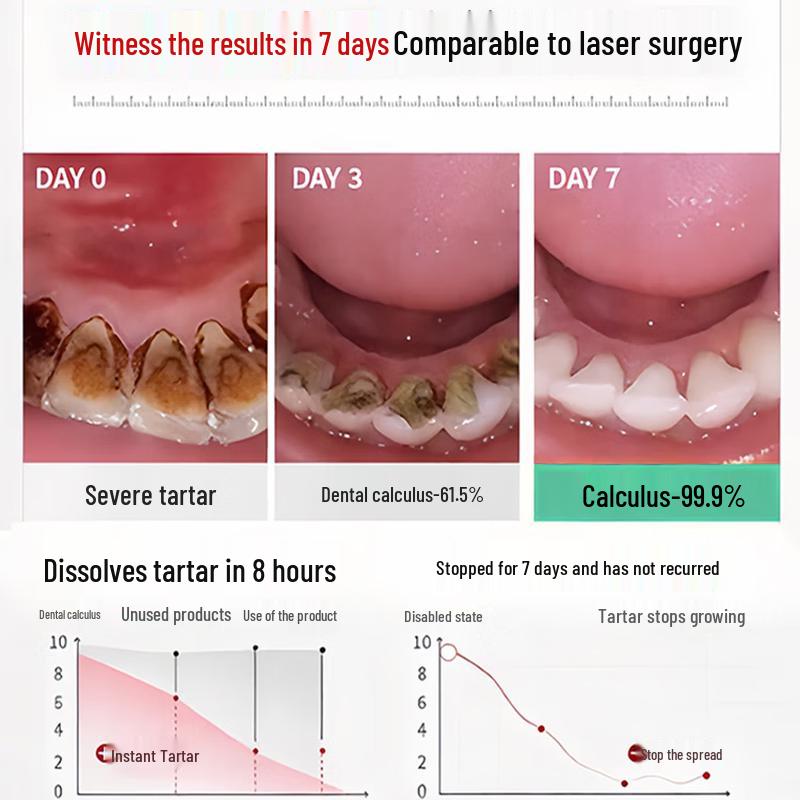 HIEUAILR Tartar Removal & Whitening Toothpaste
