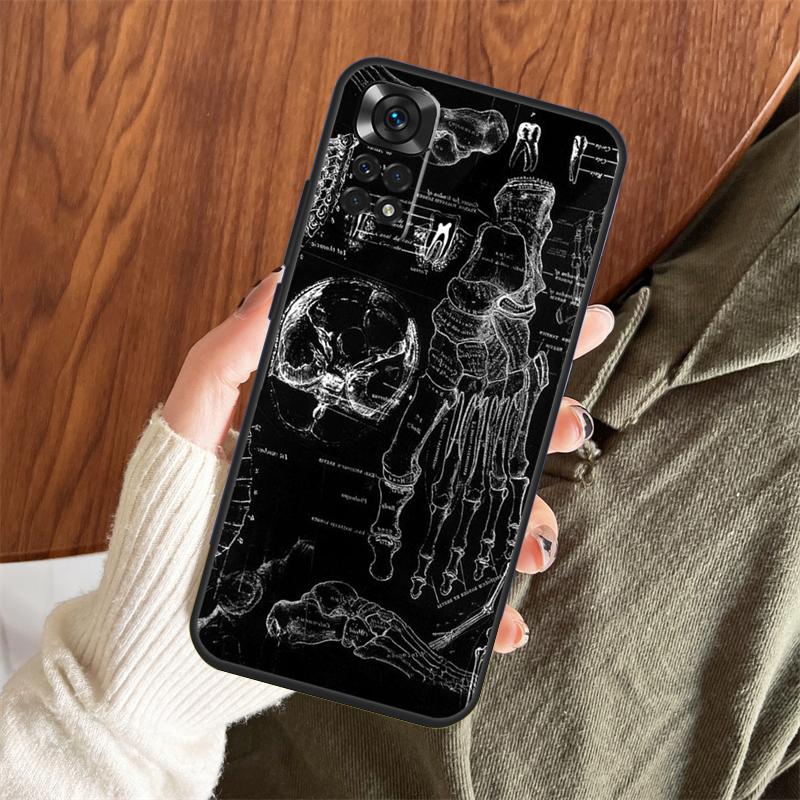 Medical Skeleton Anatomy Case For Xiaomi Redmi Note 13 14 Pro 12 11 10 15 Pro Plus Redmi 15 C 13 10C 12C 13C 14C Cover