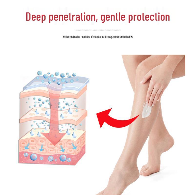 Far-Infrared Anti-Inflammatory Varicose Veins Gel