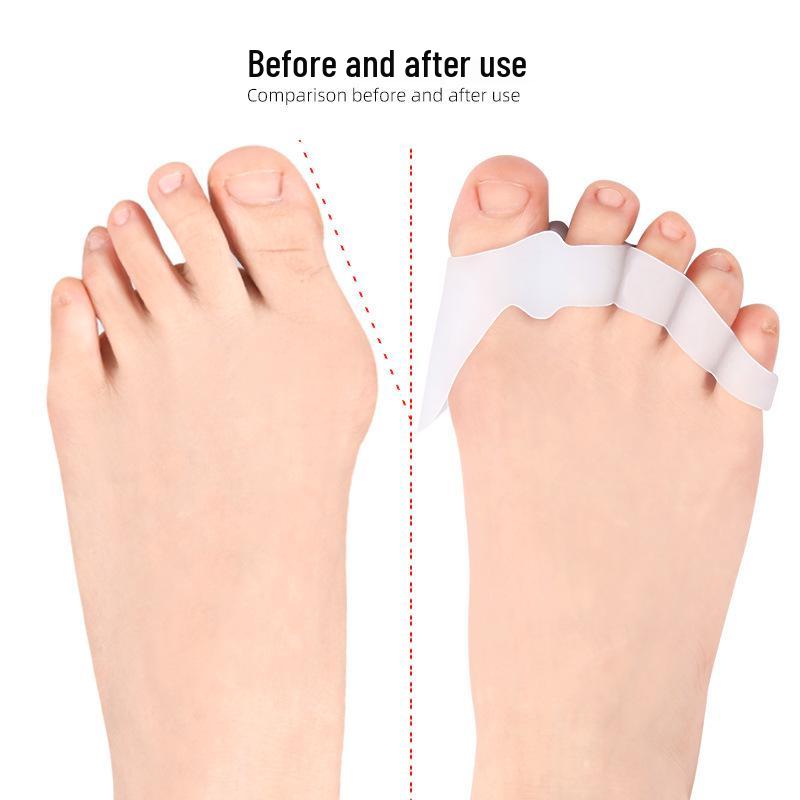 Silicone Bunion Corrector & Five-Hole Toe Separator for Overlapping Toes and Hallux Valgus