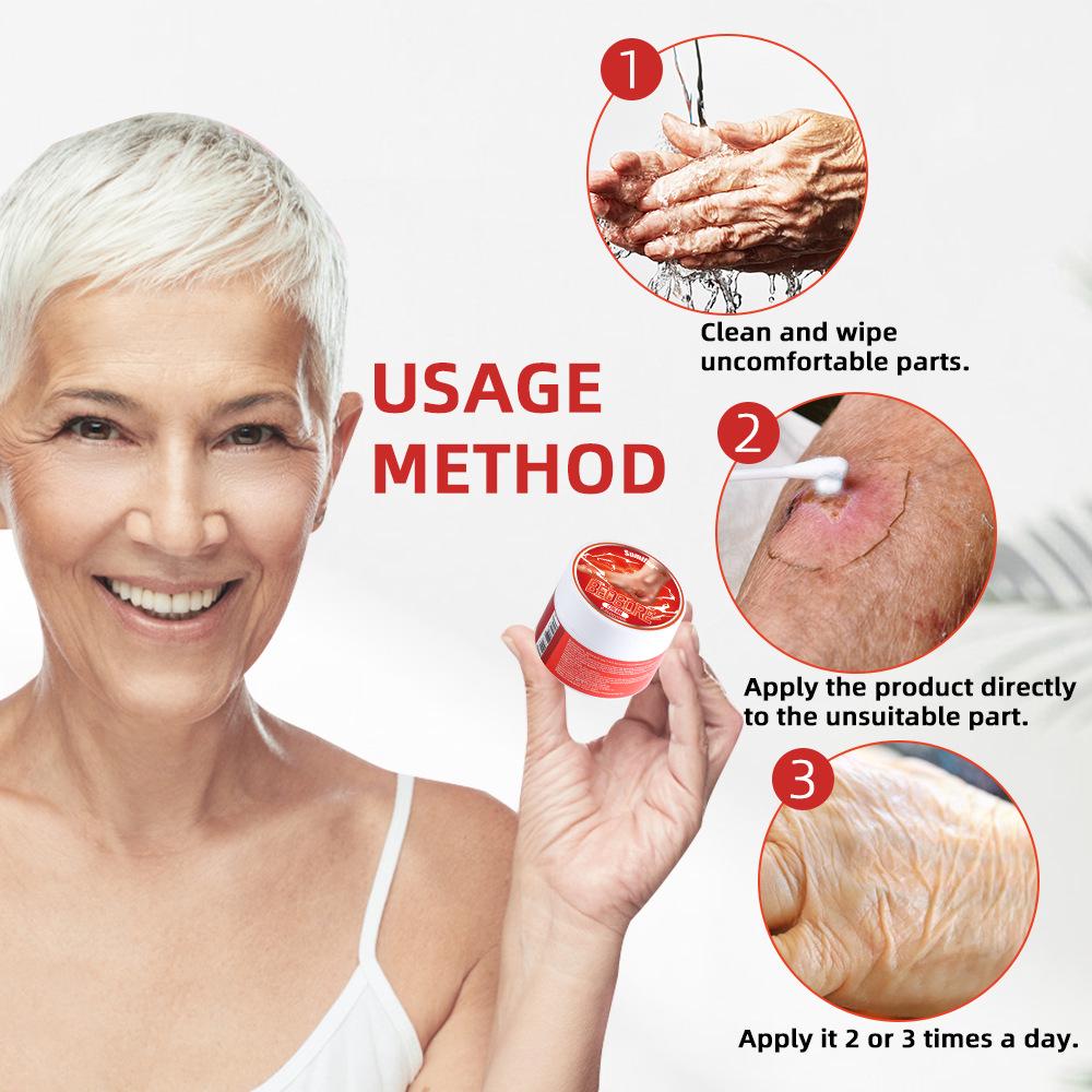 Sumifun Bedsore Care Cream for Elderly - Pressure Ulcer Relief (K20045)