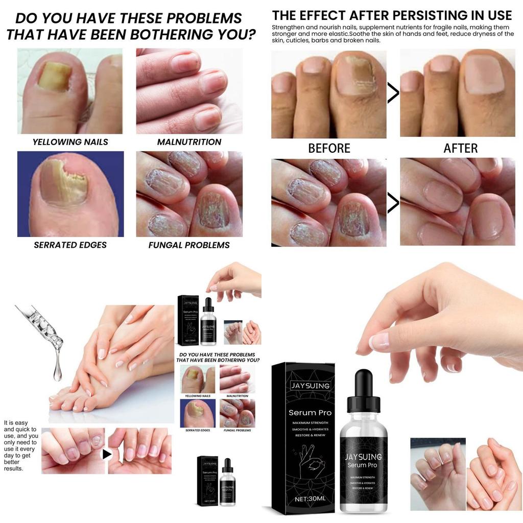 Nourishing Jaysuing Nail Repair Essence For Healthy Strong Nails 30ml