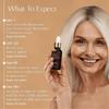 Rejuvenate Gesichtsserum, Rejuvenate Resurfacing Hautpflege Gesichtsserum, Verjüngung, Anti-Falten und Entfernung dunkler Flecken, Tiefenhydratation, für Männer & Frauen