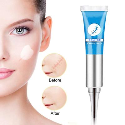 Crema Efficace Estratti Vegetali Naturali Ammorbidisce Ripara Rimuove Cicatrici Gel per la Bellezza