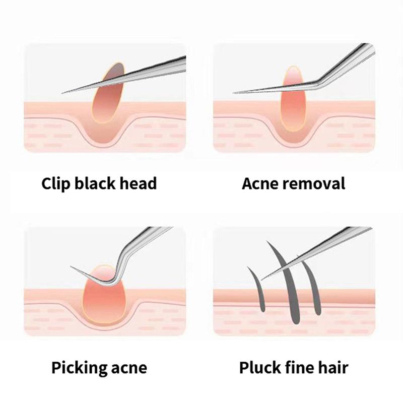 Pęsety do igieł do trądziku Lekkie zaskórniki Usuwanie pryszczów Pointed Bend