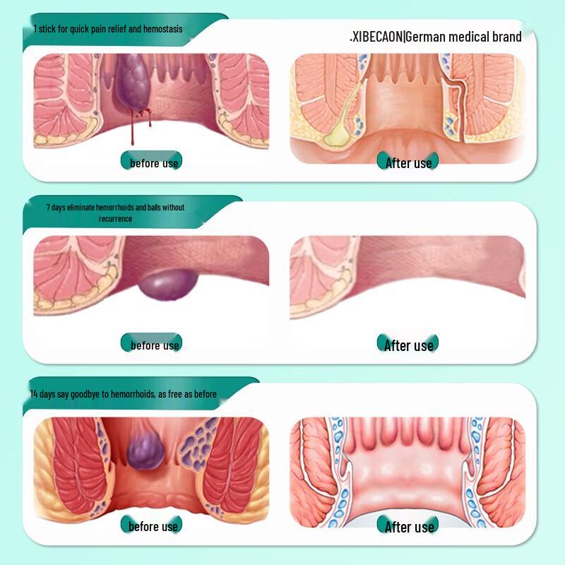 XIBELAON Health Cream