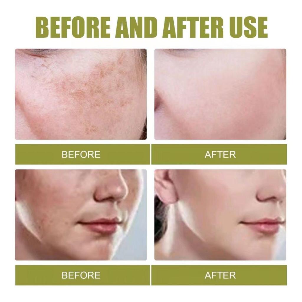 Retinol Cream Nourishing Refreshing Face Blemish Cream Collagen Facial Cream