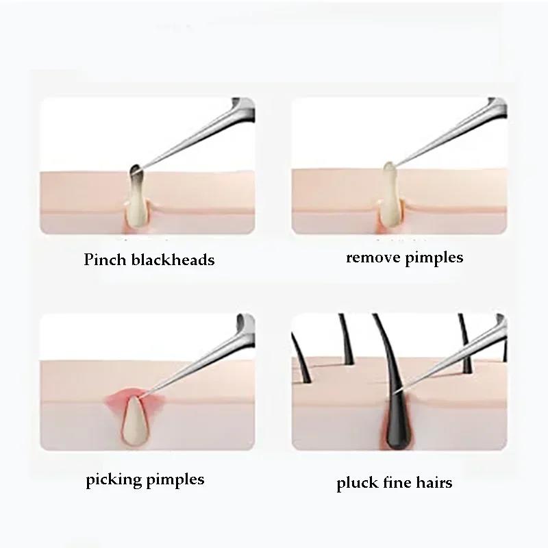 4-11Pcs Ingrown Hair Tweezers Acne Blackhead Removal Needles Black Dots Cleaner Deep Cleansing Pore Cleaner Face Skin Care Tools 3