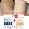 Body Whitening Cream Keratosis Pilaris Treatment Bumpy Rough Chicken Follicle Skin Repair Strawberry Legs Removal Dry Skin Care