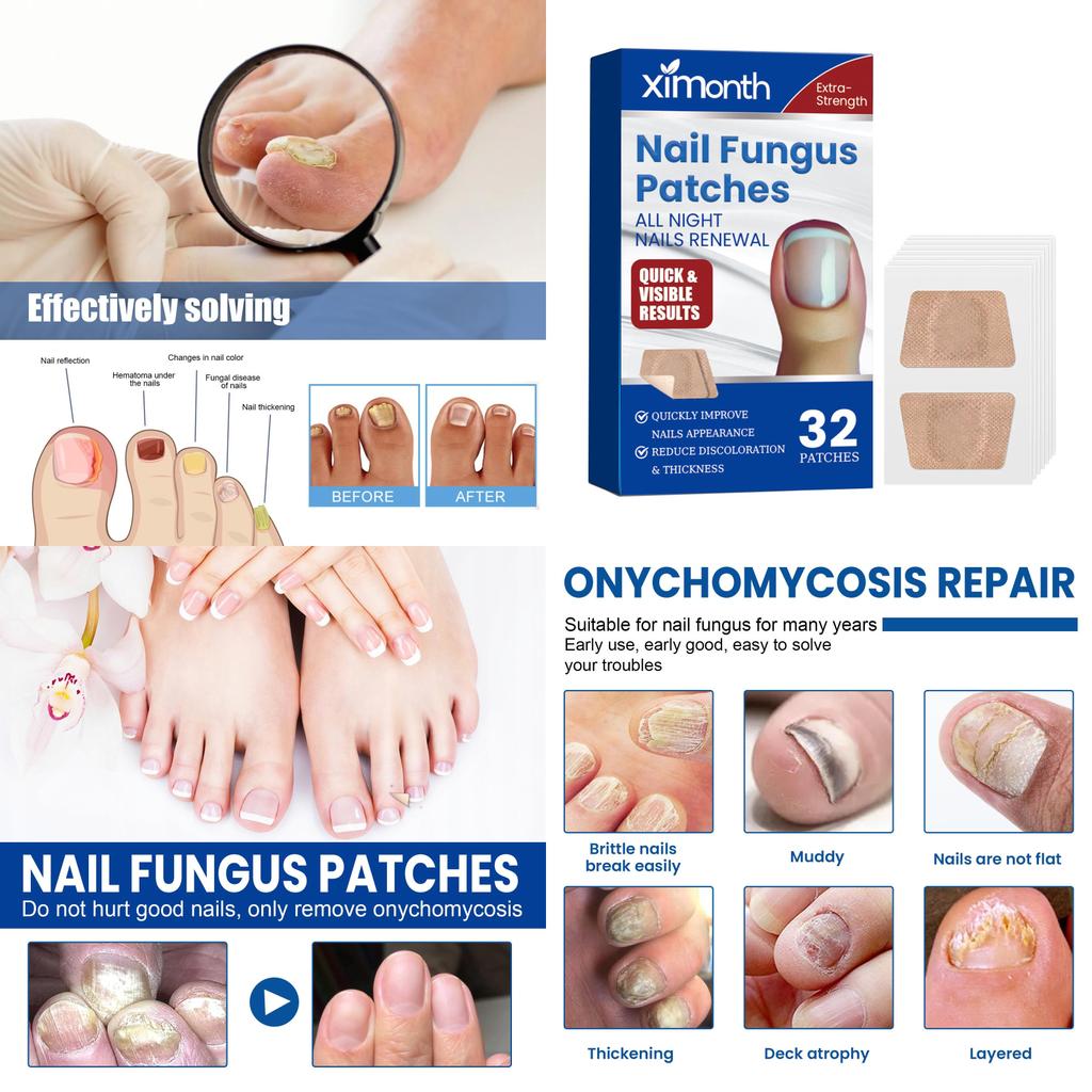 Ximonth Nail Care Patches Repairing Thickening Strengthening For Damaged Nails