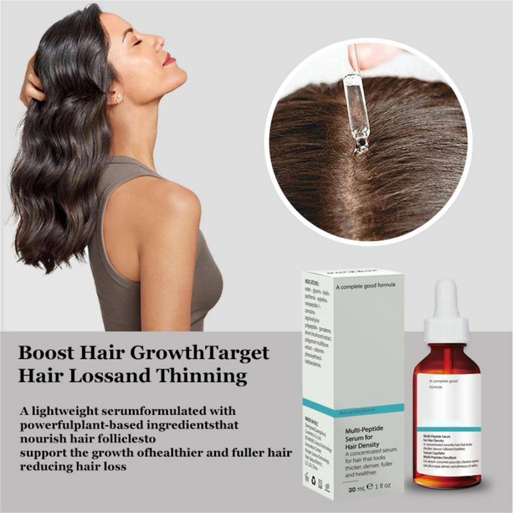 The Hair Growth Serum,Ordinary Hair Growth Serum,Ordinary Multi-peptide Serum For Hair Density,Designed For Thinning Hair & Hair Loss,(30ml)