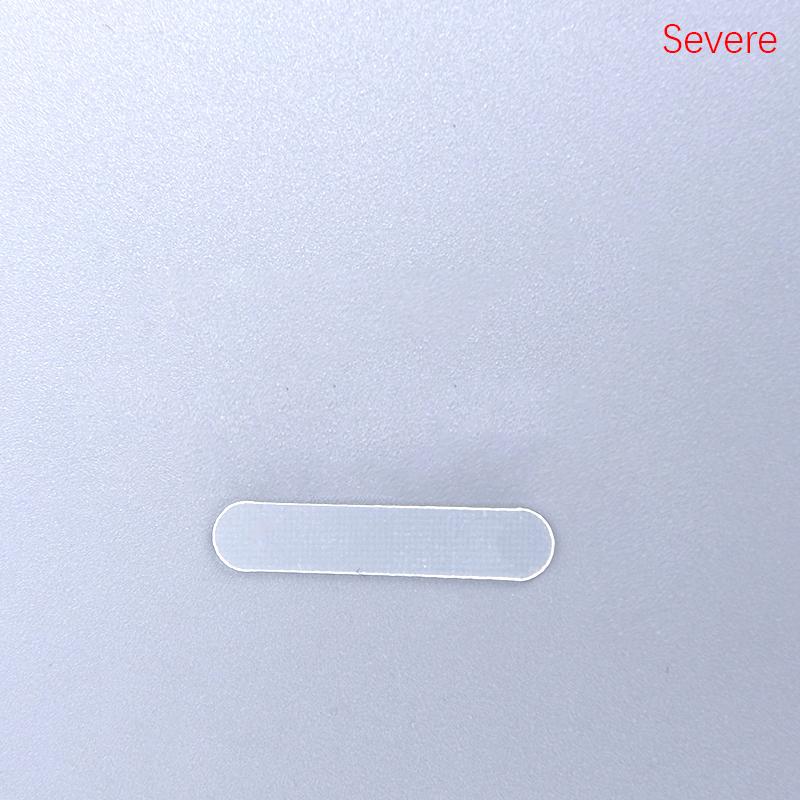 10Pcs Ingrown Toenail Correction Tool Toe Nail Treatment Elastic Patch Sticker