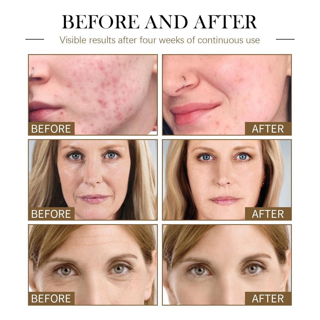 Facial Moisturizing Oil Facial Firming Moisturizing  Darkness Fade Fine Lines Anti-aging Anti-wrinkle 30ml
