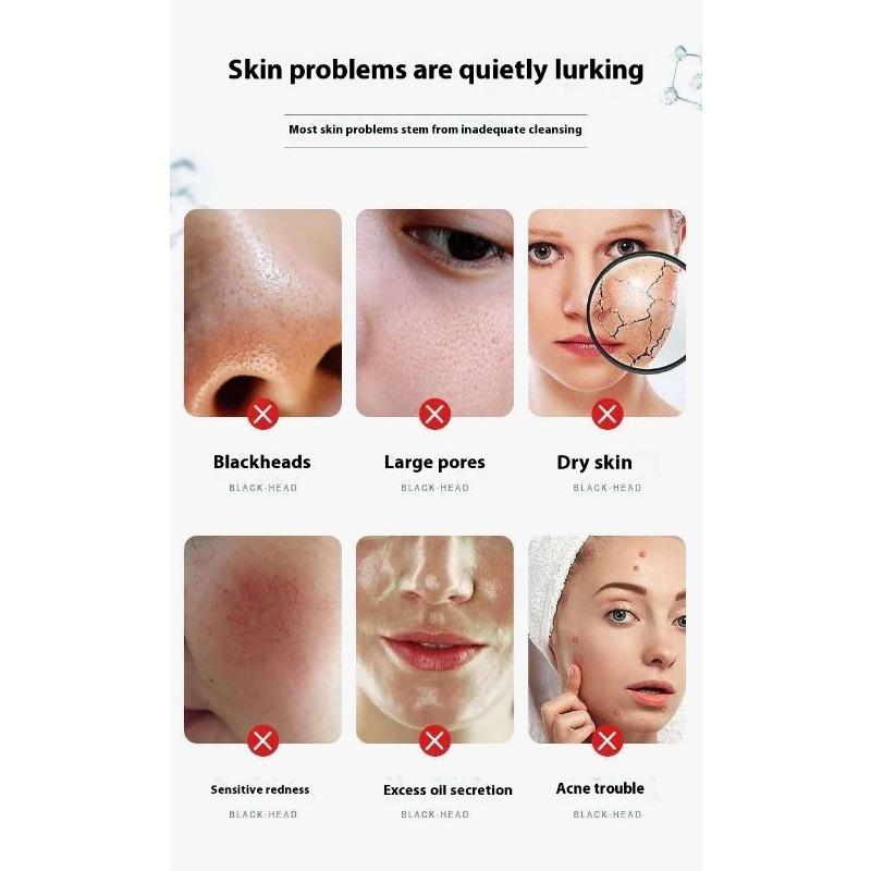 Ice Crystal Cleansing Gel Cleansing Cream for Face Blackening Discharge Black Toxins Blackhead Acne Shrinking Pores for Beauty