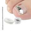 Ingrown Tool Toe Nail Treatment Fingernail Toenail Removal Correction