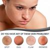 Ouhoe Dark Spot Repair Facial Serum - Softens Keratin, Repairs Dull Skin, Reduces Dark Spots, Brightens Skin