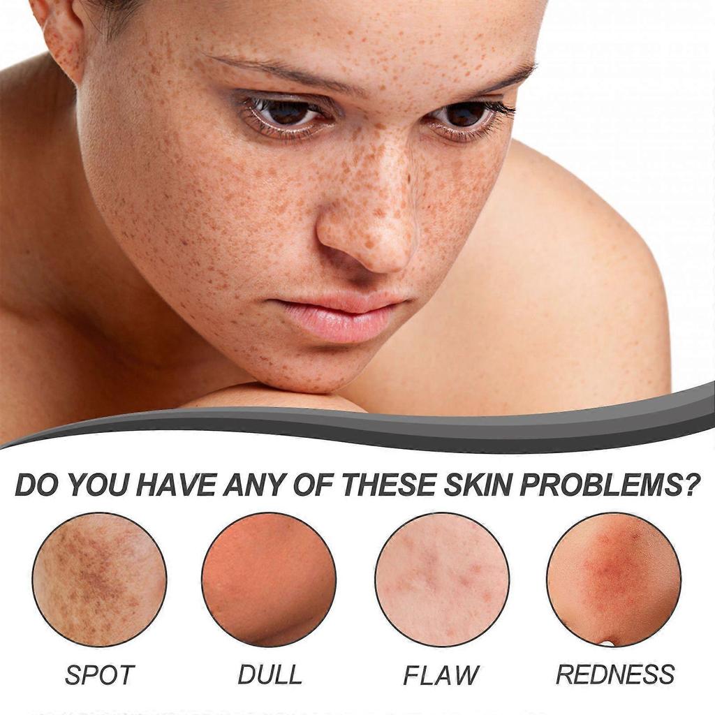 Ouhoe Dark Spot Repair Facial Serum - Softens Keratin, Repairs Dull Skin, Reduces Dark Spots, Brightens Skin