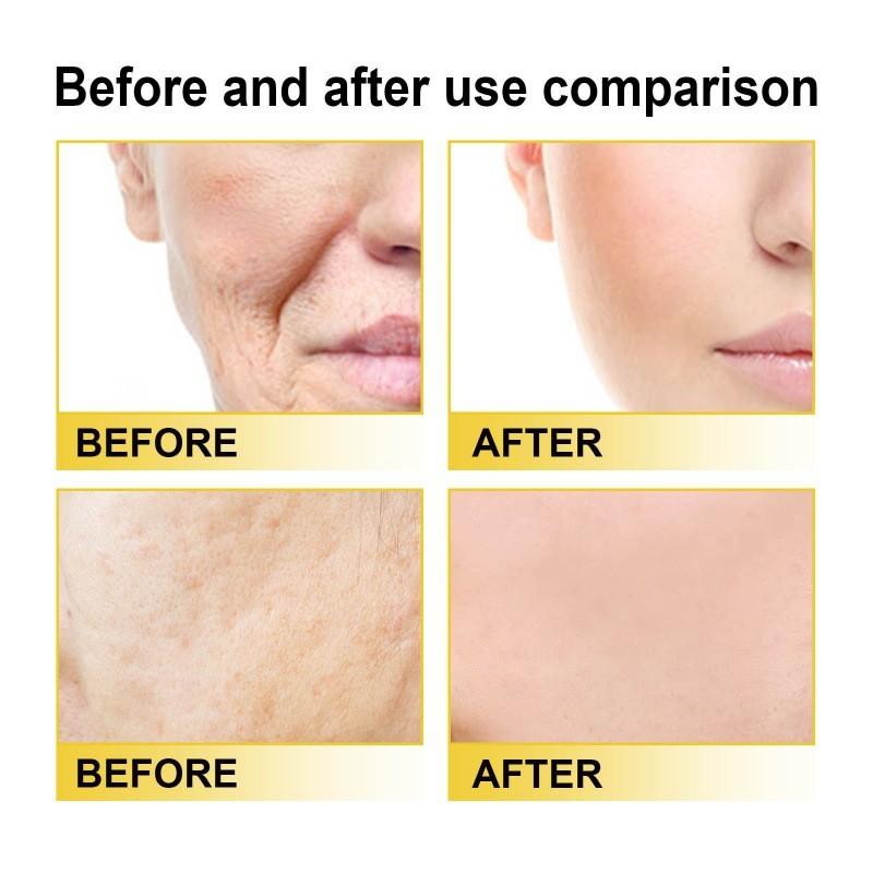 West Month Vitamin C Facial Serum For Radiant Skin Tightening And Smoothing With Moisturizing Benefits