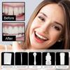 2025 Tooth Repair Kit, Dental Care Kit Glue For Filling Missing, Broken Teeth, Crowns And Bridges, Moldable Fake Teeth