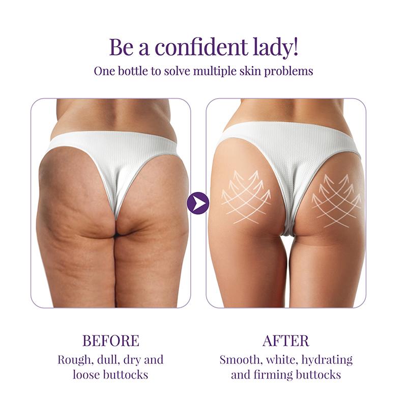 Buttock Whitening Cream Hips Butt Moisturizing Smoothing Hydrating Skin Brightening Body Care Cosmetics for Women