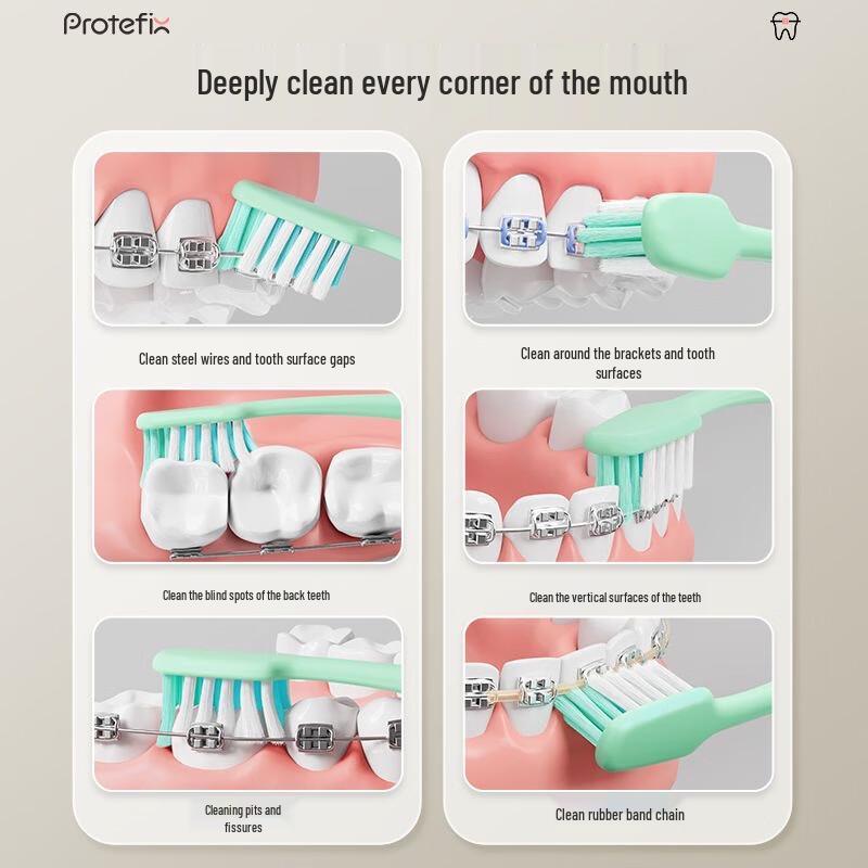 PROTEFIX X-Type Orthodontic Toothbrush for Braces (2-Pack)