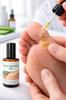 OOTHEKA Corn Removal Gel for Feet with Lactic Acid Roll-On | Callus & Hard Skin Remover | Repairs Cracked Heels & Softens Dry Rough Skin (30ml, Al