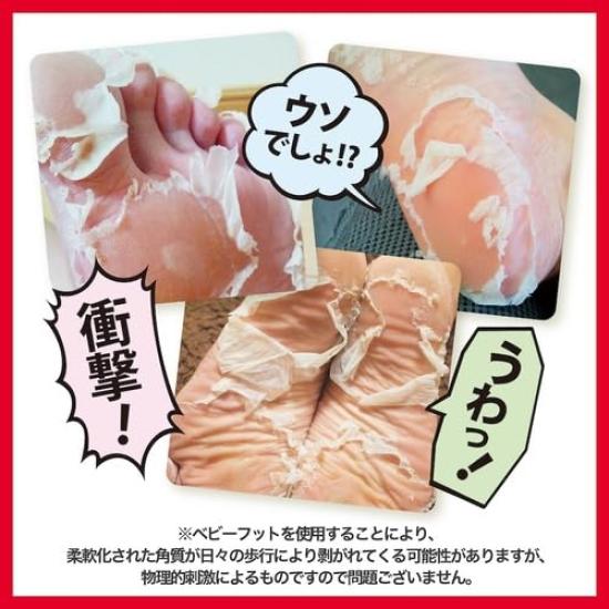Baby Foot Easy Cinnamoroll Includes Original Heel Callus Care to Pack, 60-Minute Type, Medium, Package, Socks, (Up 27cm)