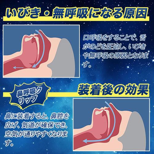 Set of 4 Anti-Snoring Nose Clips, Sleep Aids, Promotes Nasal Breathing, Washable, Includes Case, Unisex