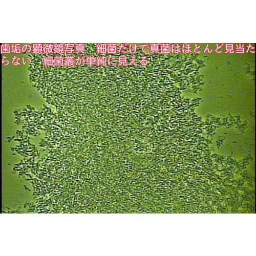 Plant-based Toothpaste Focuses On Fungi Such As Candida In the Mouth. Contains Seven Plant-based Ingredients That Fight Fungi. Refreshes the Mouth. No