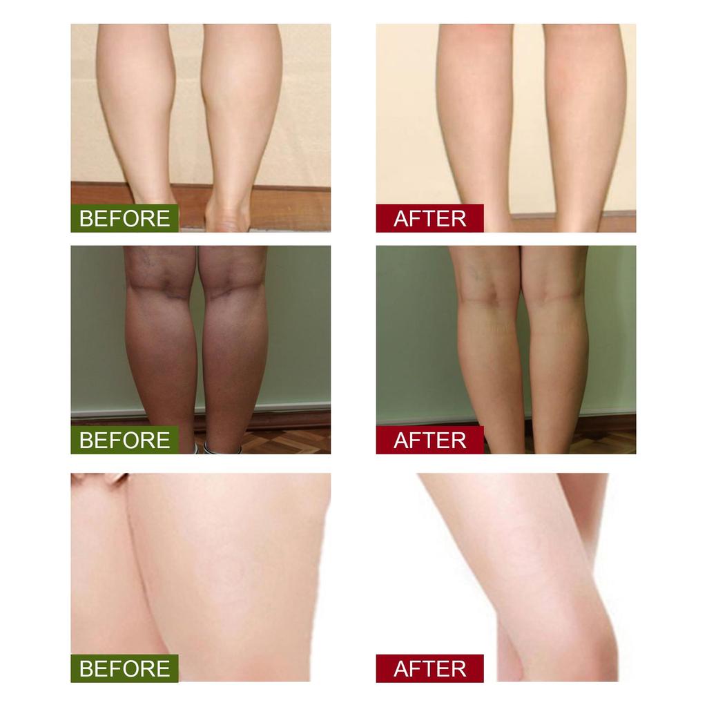 South Moon Ginger Foot Bath Pack: Promotes Lymphatic Drainage, Cleanses and Relaxes the Body, and Relieves Leg Swelling. 10 Pieces.