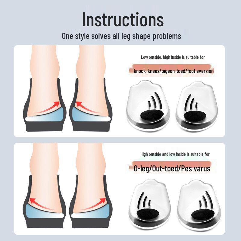 O-leg Silicone Correction Insole: 4th Gen Volcanic Magnetic Heel Pad for X/XO-Type Alignment