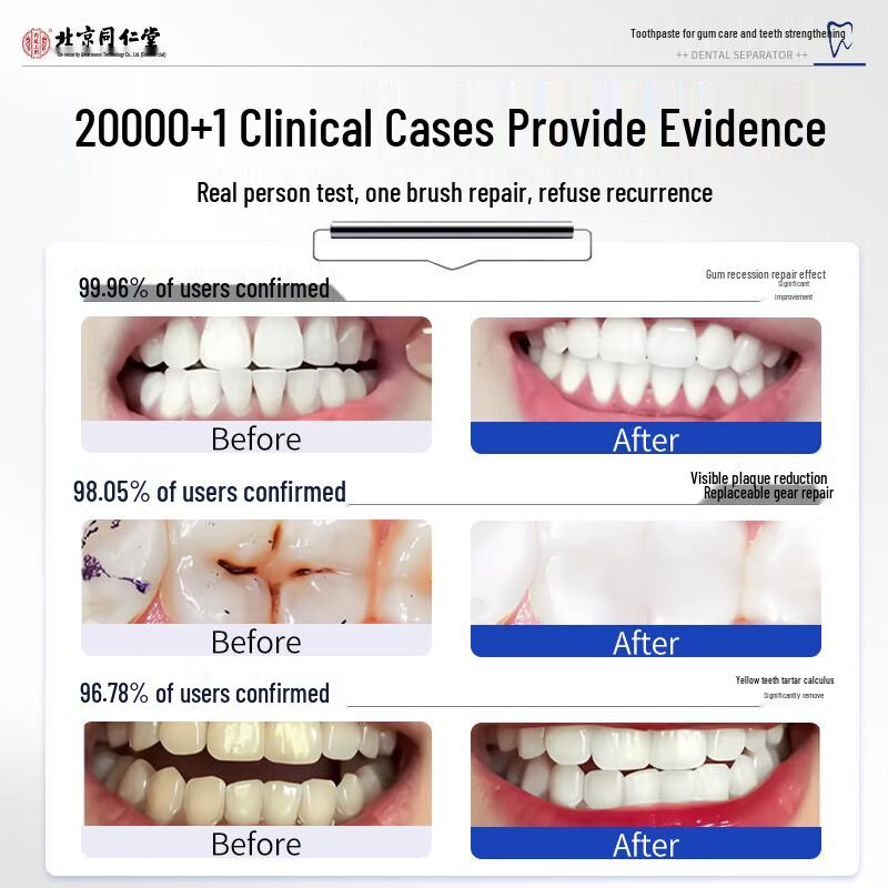 Tong Ren Tang Therapeutic Dental Toothpaste