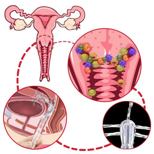 TOUFEIYUAN Multipurpose Enema Pump with Enema Syringe, Clean Shower, and Manual Pump for Bowel Movements, Unisex, 600ml Capacity, Includes One 60cm Tu