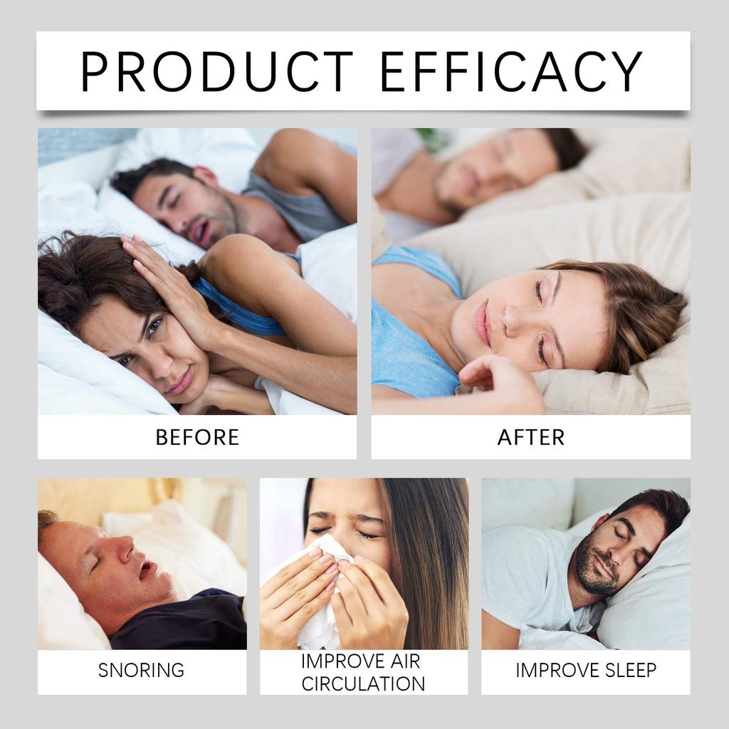 Anti-Snoring Sleep Nose Patch Relieves Nasal Discomfort And Ensures A Comfortable Night's Sleep