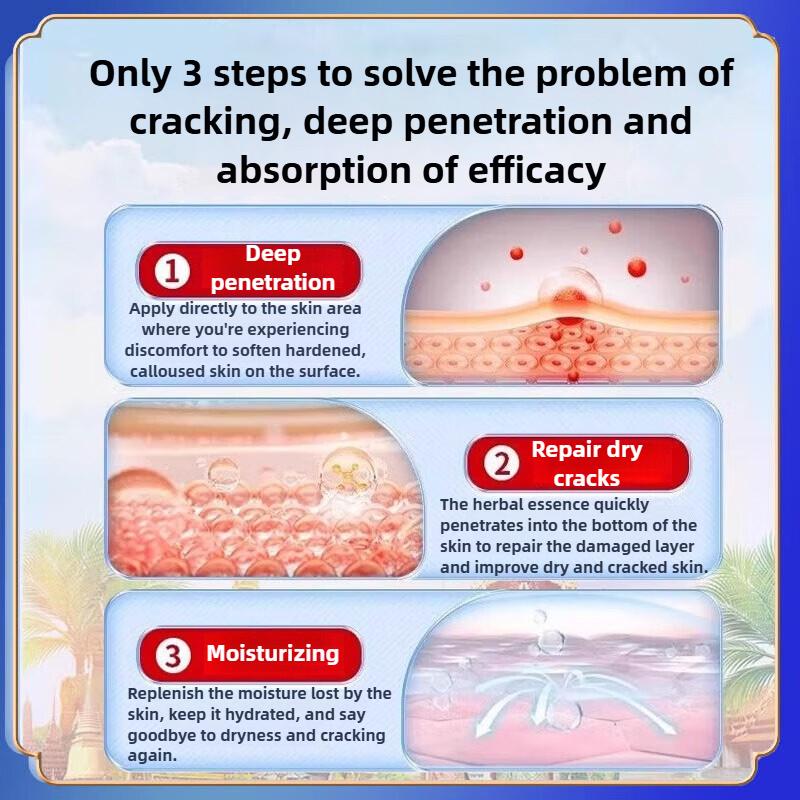 Dry and cracked fingers ointment, relieve pain and heal cracks, restore smooth skin