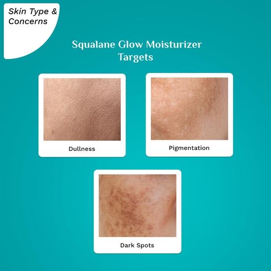 Pilgrim Squalane Niacinamide & Vitamin C Glow Moisturizer for Face | Moisturizer for Dry Skin Hydration  | 50 Gm,Cream