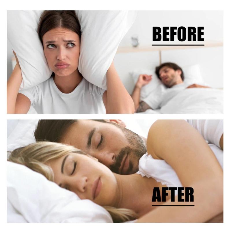 respiratory care anti snoring device to prevent snoring at night, orthodontic braces to prevent snoring and ensure stable sleep