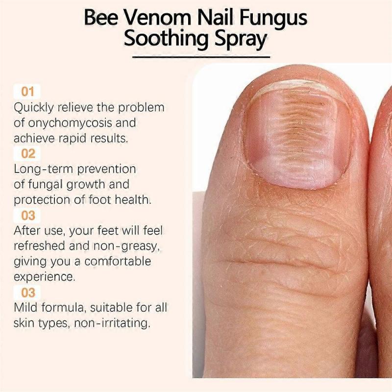 3pcs Bee Venom Nail Treatment Serum Toenail Serum Liquid Nail Growth and Repair 20ml