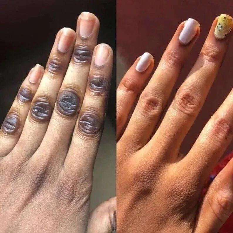 Multifunctional Facial Serum with Kojic Acid, Arbutin and Glutathione Dark Skin Whitening and Dark Spot Brightening 30ml