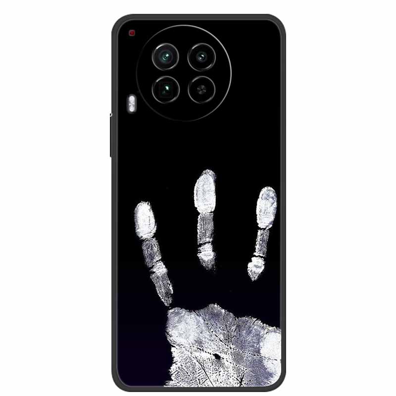 For Tecno Camon 30 4G Case Luxury TPU Soft Silicone Back Cover for Tecno Camon30 4G CL6 Protective Shockproof Cute Phone Coque
