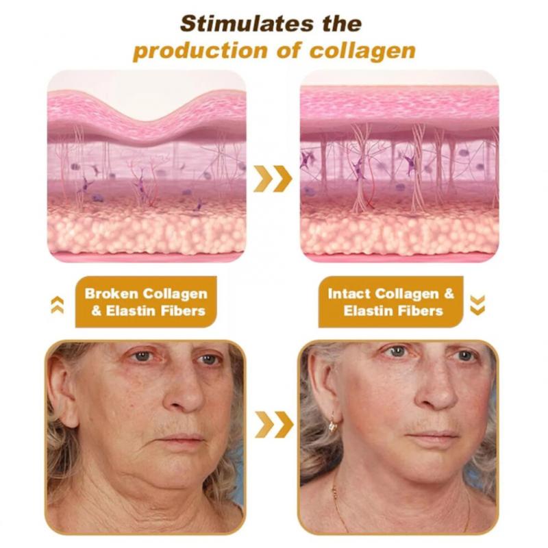 3PCS  Bee Venom Wrinkle Cream Bee Venom Skin Treatment Cream Anti-Wrinkle Firming Anti-Aging Moisturizing Lifting & Recovery for All