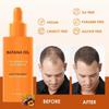 2 In 1 Raw Batana Oil for Hair Growth Set - 100% Pure Organic Batana Oil for Thicker & Stronger Hair - Batana Oil with Rosemary & Jojoba Oil, Prevent 