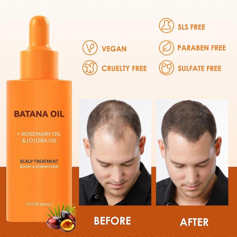 2 In 1 Raw Batana Oil for Hair Growth Set - 100% Pure Organic Batana Oil for Thicker & Stronger Hair - Batana Oil with Rosemary & Jojoba Oil, Prevent 