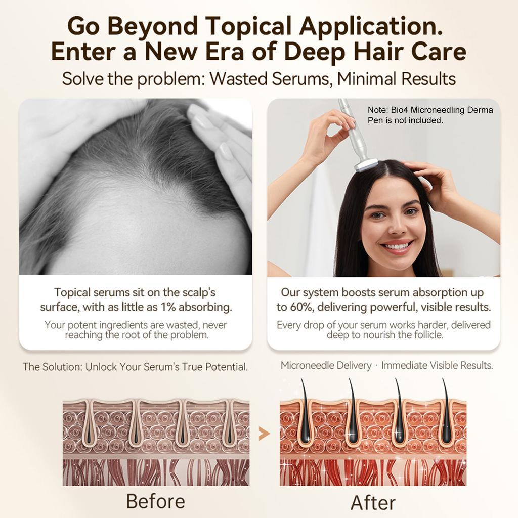 64-Needle Head Fit for Bio4 Microneedling Derma Pen, Microneedling Replacement Head,   Needle Depth (0-3.0mm), At-Home Scalp Care for Thinnin