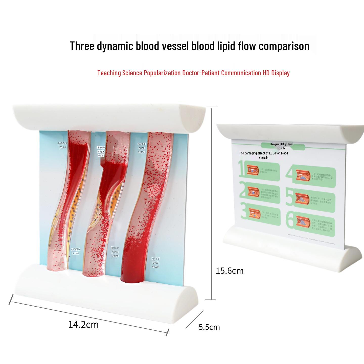 Dynamic Hyperlipidemia Vascular Occlusion Model: Pathological & Viscosity Teaching Tool A023611