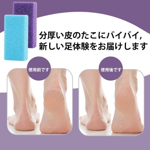 Natural Pumice Stone for Foot Care [Set of 2] Pumice Stone, Heel File, Callus Remover, Foot Care Tool, Heel Callus Removal, Improves Blood Circulation
